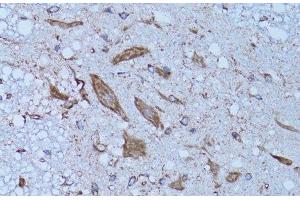 Immunohistochemistry of paraffin-embedded Rat spinal cord using HADH Polyclonal Antibody at dilution of 1:100 (40x lens). (HADH Antikörper)