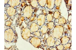 Immunohistochemistry of paraffin-embedded human thyroid tissue using ABIN7149332 at dilution of 1:100 (PITPNC1 Antikörper  (AA 1-268))