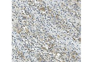 IHC analysis of CARD9 using anti-CARD9 antibody (ABIN7599386).