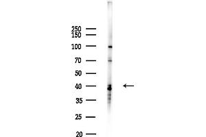 anti-General Transcription Factor IIIA (GTF3A) (N-Term) antibody
