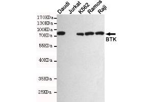 Western blot detection of BTK in Daudi,Jurkat(BTK negative),K562,Ramos and Raji cell lysates using BTK mouse mAb (1:1000 diluted). (BTK Antikörper)