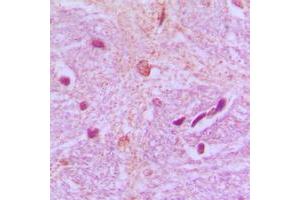 Immunohistochemical analysis of TBX15/18 staining in human brain formalin fixed paraffin embedded tissue section. (T-Box 15/18 Antikörper  (Center))