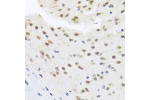 Immunohistochemistry of paraffin-embedded mouse brain using HD antibody (ABIN6128012, ABIN6141669, ABIN6141672 and ABIN6213648) at dilution of 1:100 (40x lens).