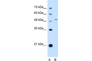 WB Suggested Anti-NR0B1 Antibody Titration:  0. (NR0B1 Antikörper  (Middle Region))