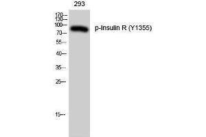 Western Blotting (WB) image for anti-Insulin Receptor (INSR) (pTyr1355) antibody (ABIN3182541) (Insulin Receptor Antikörper  (pTyr1355))
