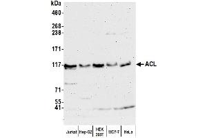 Western Blotting (WB) image for anti-ATP Citrate Lyase (ACLY) (AA 350-400) antibody (ABIN7449939)