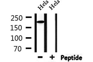 Western blot analysis of extracts from Hela, using Collagen Valpha 1 Antibody. (COL5A1 Antikörper  (N-Term))