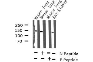 Western blot analysis of Phospho-Met (Tyr1234) expression in various lysates