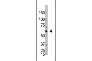 OASL Antikörper  (C-Term)