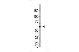 The anti-OASL C-term Antibody (ABIN390168 and ABIN2840664) is used in Western blot to detect OASL in HL60 lysate. (OASL Antikörper  (C-Term))
