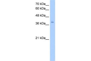 WB Suggested Anti-PCBP2 Antibody Titration:  2. (PCBP2 Antikörper  (N-Term))
