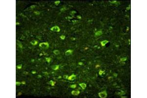 Immunofluorescence analysis of ABI1 antibody with paraffin-embedded human brain tissue.