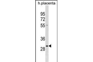 RAB22A Antibody (C-term) (ABIN1536769 and ABIN2850288) western blot analysis in human placenta tissue lysates (35 μg/lane). (RAB22A Antikörper  (C-Term))