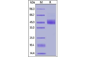 SDS-PAGE (SDS) image for Transforming Growth Factor, beta 1 (TGFB1) (AA 30-278) (Active) protein (His tag,AVI tag,Biotin) (ABIN6731275)