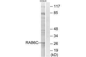 Western blot analysis of extracts from COLO cells, using RAB6C antibody. (WTH3DI Antikörper  (Internal Region))