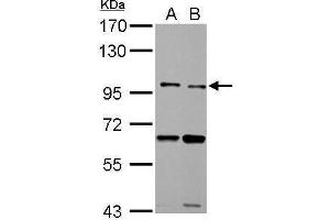 WB Image TLR5 antibody detects TLR5 protein by Western blot analysis. (TLR5 Antikörper  (N-Term))