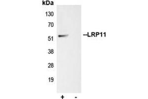 Immunoprecipitation of LRP11 from 0. (LRP11 Antikörper  (Center))