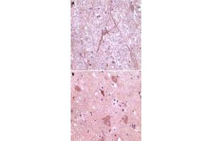 Immunohistochemical analysis of paraffin-embedded human cerebrum (A) and myelencephalon (B) tissue, showing cytoplasmical localization, using DNM2 monoclonal antibody, clone 5E4C2F3  with DAB staining. (DNM2 Antikörper)