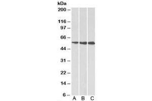Western blot testing of A) HeLa, B) HepG2 and C) K562 cell lysate using HMGCS1 antibody at 1ug/ml. (HMGCS1 Antikörper)