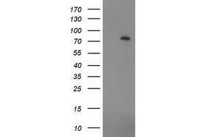 Western Blotting (WB) image for anti-Zinc Finger, Imprinted 2 (ZIM2) (AA 1-150), (AA 428-527) antibody (ABIN1490589) (ZIM2 Antikörper  (AA 1-150, AA 428-527))