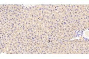 Detection of PCK1 in Mouse Liver Tissue using Polyclonal Antibody to Phosphoenolpyruvate Carboxykinase 1, Soluble (PCK1) (PCK1 Antikörper  (AA 312-563))