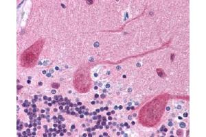 Immunohistochemistry (Paraffin-embedded Sections) (IHC (p)) image for anti-Growth Factor Receptor-Bound Protein 2 (GRB2) (AA 198-217), (C-Term) antibody (ABIN615588)