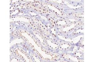 ABIN6267315 at 1/200 staining human kidney tissue sections by IHC-P. (Retinoblastoma 1 Antikörper  (pSer780))
