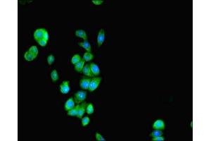 Immunofluorescent analysis of PC-3 cells using ABIN7162107 at dilution of 1:100 and Alexa Fluor 488-congugated AffiniPure Goat Anti-Rabbit IgG(H+L) (SEPSECS Antikörper  (AA 5-451))
