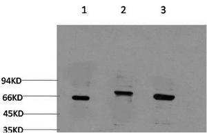 Western Blot analysis of 1) 293T, 2) C2C12, 3) Rat brain using BECN1 Monoclonal Antibody at dilution of 1:2000. (Beclin 1 Antikörper)