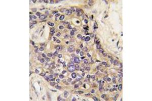 Image no. 2 for anti-Hepatocyte Growth Factor (Hepapoietin A, Scatter Factor) (HGF) (C-Term) antibody (ABIN357192)