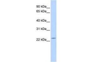 Image no. 1 for anti-Deleted in Primary Ciliary Dyskinesia Homolog (DPCD) (AA 36-85) antibody (ABIN6743816) (DPCD Antikörper  (AA 36-85))