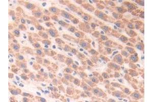 Detection of ECH1 in Human Liver Tissue using Polyclonal Antibody to Enoyl Coenzyme A Hydratase 1, Peroxisomal (ECH1)