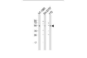 All lanes : Anti-ZN Antibody (N-Term) at 1:2000 dilution Lane 1: HT-1080 whole cell lysate Lane 2: SH-SY5Y whole cell lysate Lane 3: Y79 whole cell lysate Lysates/proteins at 20 μg per lane. (ZNF513 Antikörper  (AA 82-115))