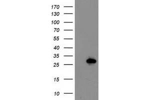 Western Blotting (WB) image for anti-Latexin (LXN) antibody (ABIN1499100) (Latexin Antikörper)