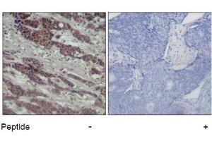 Image no. 2 for anti-V-Raf-1 Murine Leukemia Viral Oncogene Homolog 1 (RAF1) (Ser338) antibody (ABIN319325) (RAF1 Antikörper  (Ser338))