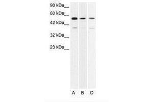 Image no. 1 for anti-H2.0-Like Homeobox (HLX) (AA 257-306) antibody (ABIN202646) (HLX Antikörper  (AA 257-306))