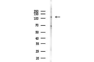 anti-Helicase-Like Transcription Factor (HLTF) (Internal Region) antibody