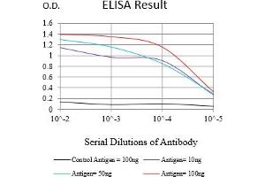 Black line: Control Antigen (100 ng),Purple line: Antigen (10 ng), Blue line: Antigen (50 ng), Red line:Antigen (100 ng) (Cytokeratin 13 Antikörper  (AA 104-458))