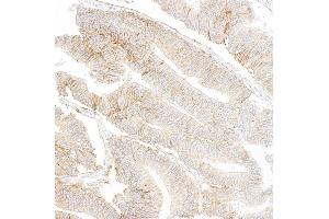 Immunohistochemistry (IHC) image for anti-Insulin-Like Growth Factor 1 Receptor (IGF1R) antibody (ABIN7795596)