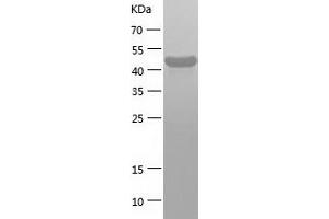 Western Blotting (WB) image for DEAD (Asp-Glu-Ala-Asp) Box Polypeptide 39B (DDX39B) (AA 1-428) protein (His tag) (ABIN7122607)