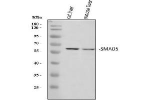 Western blot analysis of SMAD5 using anti-SMAD5 antibody (ABIN7602972).