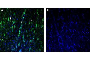 Expression of TMEM175 in rat medial septum. (TMEM175 Antikörper  (AA 278-291))
