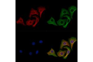 Vimentin mouse monoclonal Antibody staining Hela cells by IF/ICC. (Vimentin Antikörper)