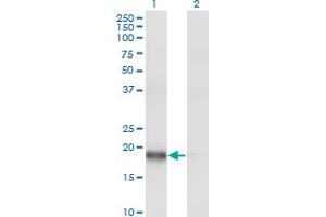 Western Blot analysis of ARPC3 expression in transfected 293T cell line by ARPC3 monoclonal antibody (M06), clone 2E11.