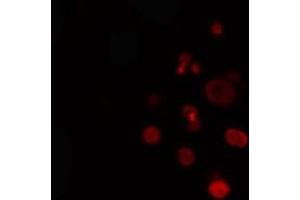 ABIN6274330 staining Hela cells by IF/ICC.