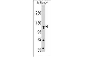 Image no. 1 for anti-Muscle, Skeletal, Receptor Tyrosine Kinase (MUSK) antibody (ABIN359904) (MUSK Antikörper)