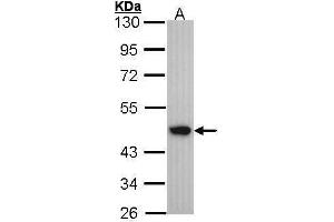 WB Image Sample (30 ug of whole cell lysate) A: A431 , 10% SDS PAGE antibody diluted at 1:1000 (Medium-Chain Specific Acyl-CoA Dehydrogenase, Mitochondrial (N-Term) Antikörper)