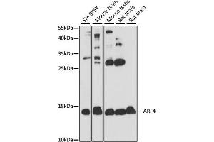 Western blot analysis of extracts of various cell lines, using  antibody (ABIN7265482) at 1:1000 dilution. (ARF4 Antikörper  (AA 1-180))