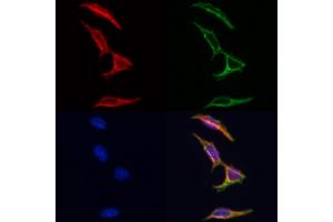 ABIN6262232 and ABIN6266695 staining Hela by IF/ICC. (HGS Antikörper  (Internal Region))