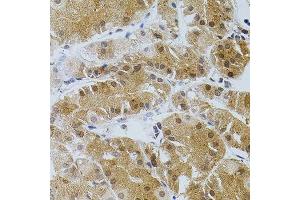 Immunohistochemistry of paraffin-embedded human stomach using TGM2 antibody. (Transglutaminase 2 Antikörper)